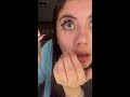 Woman Has Hairy Situation In Her Eye 