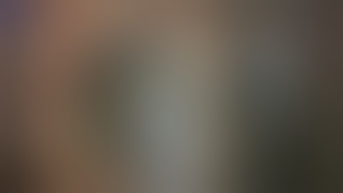 Phacoemulsification - Divide & Conquer technique - Dr Sri Ganesh