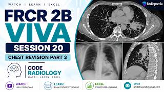 Radiology FRCR 2B Mock Viva and Radiology Interesting Cases
