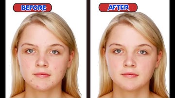 How To Use Spot Healing Brush Tool In Photoshop | Shabi Graphics |