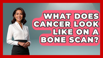 What Does Cancer Look Like on a Bone Scan? - Oncology Support Network