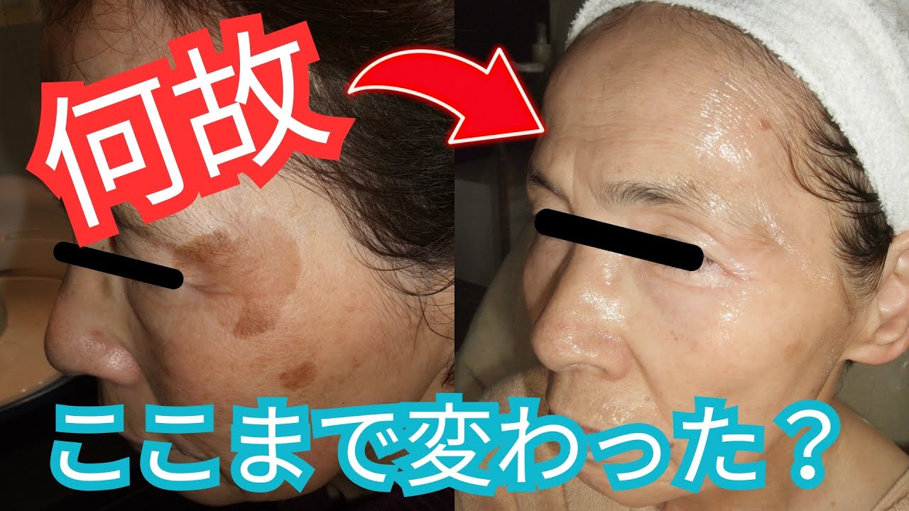 「シミ」「シワ」ここまで変わる