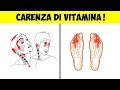 Mai Ignorare Questi 10 Segni Di Carenza Di Vitamina B12!