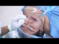 Anesthesia procedure before Surgery