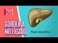 Esteatose hepática (gordura no fígado)  - Mulheres (24/07/18)