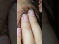 Asmr hair Satisfying Massage therapy #diy #ingrownhair #shorts #video #scratch #sound #beard