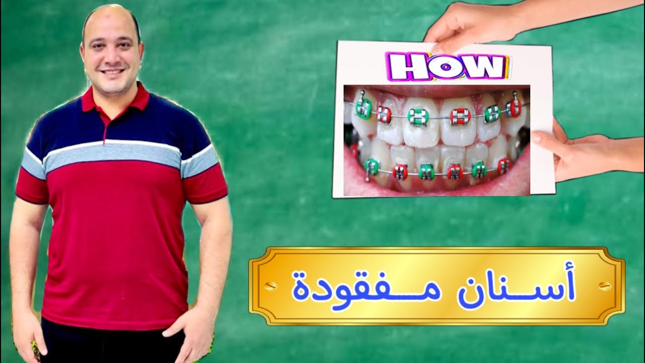 تقويم أستثنائي | كيفية تقويم الأسنان في حاله أسنان مفقوده؟ #دكتور_اسلام_نبيل
