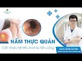 NẤM THỰC QUẢN - Cẩn thận hệ tiêu hoá bị tấn công