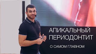 Юрий Кочаров. Апикальный периодонтит. Всё, что нужно знать.