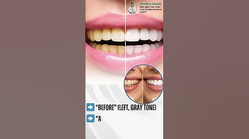 ✨ Transform Your Smile with the Best Dentist Doctor in Varanasi! ✨