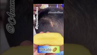 Viral Hair Growth Serum/Hair growth tips 16 #shorts #haircare #youtubeshorts Anamika Barai