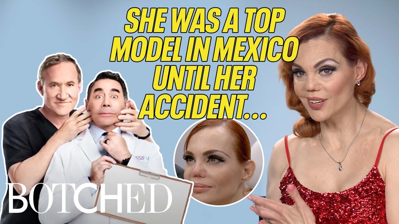 A Suitcase Fell on Carmen's Face, Breaking Her Nose!? | Botched | E!