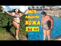 Лишняя кожа после похудения//Обвисший живот//Кофейный скраб//худею без диет//минус34кг