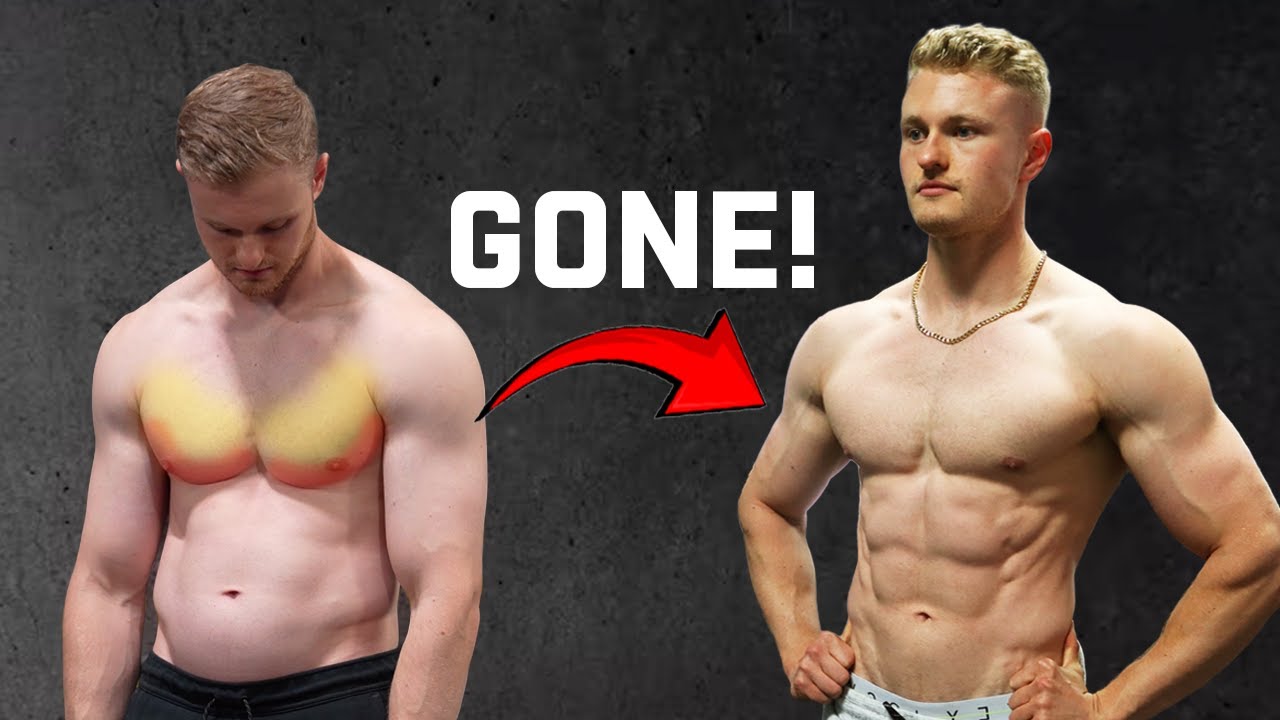 How to Get Rid of MAN BOOBS (Chest Fat Fix!) - YouTube