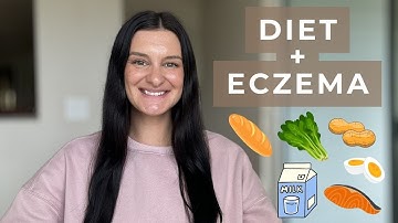 The Best Diet for Eczema | Foods to AVOID & Foods to INCREASE | ECZEMA SERIES #1