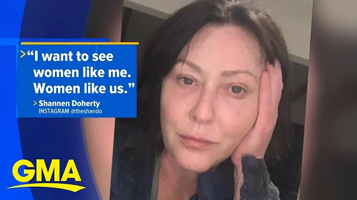 Shannen Doherty calls out Hollywoods Botox obsessi...