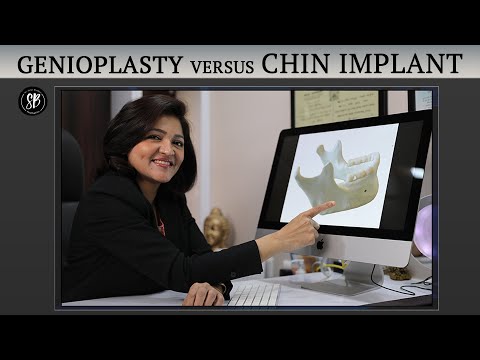 Everything you need to know about #Genioplasty | Chin Augmentation & Chin Reduction | Chin Surgery