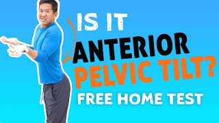 Do I Have Anterior Pelvic Tilt? Common APT Myths Busted
