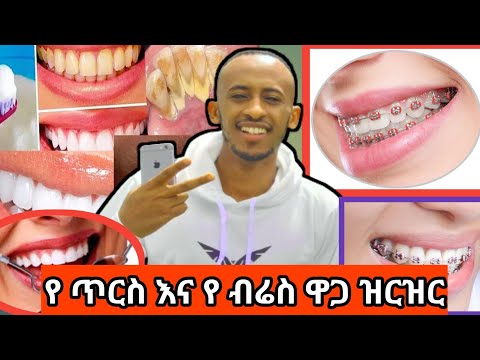 ቪዲዮ: የተሰበረ የብሬስ ሽቦን እንዴት ማስተካከል እንደሚቻል 6 ደረጃዎች (ከስዕሎች ጋር)