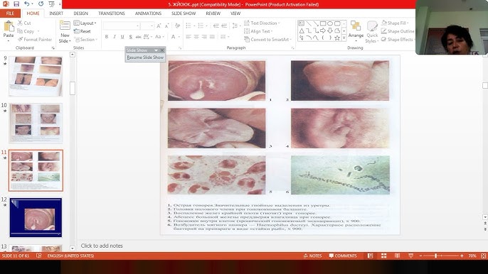 YouTube jinsiy buzuqlik Cape Dogistonda porno
