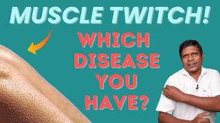 Why Your Muscle Twitch? When should you get Alert!