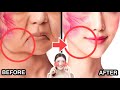 BEST CHEEK LIFTING MASSAGE FOR LAUGH LINES, CHEEK FAT TO LOOK 10 YEARS YOUNGER &amp; BEAUTIFUL
