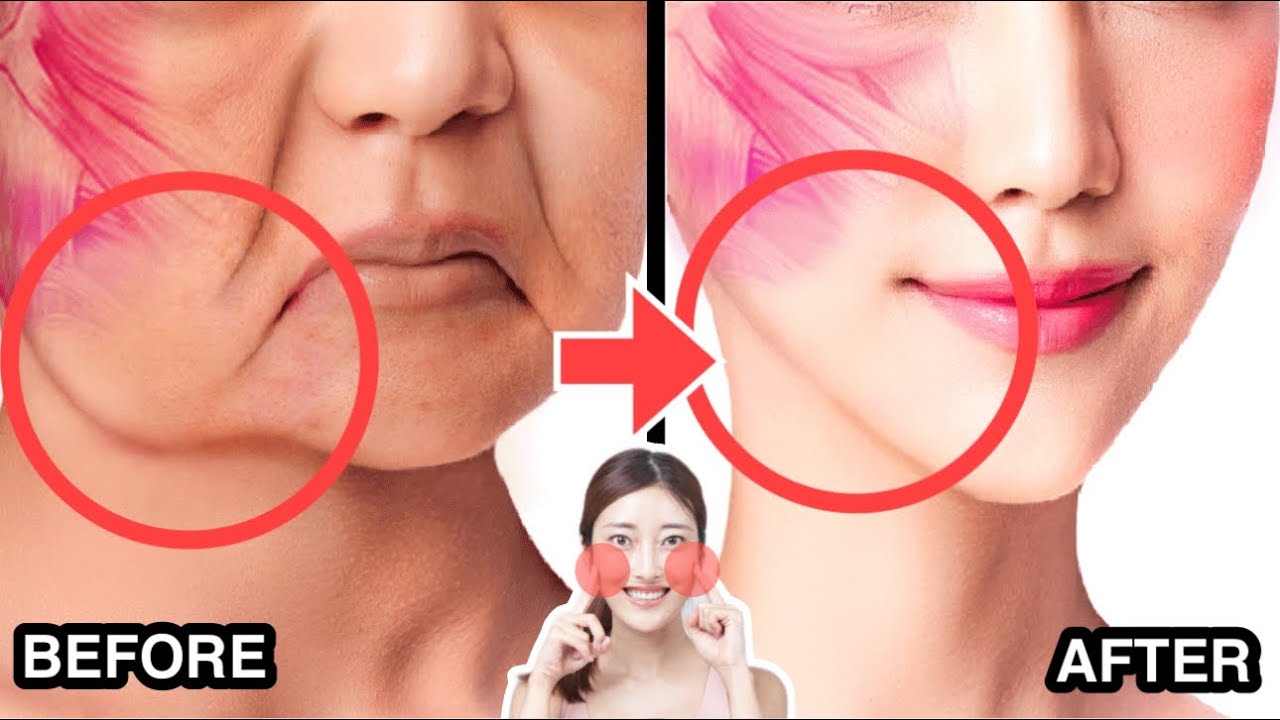 BEST CHEEK LIFTING MASSAGE FOR LAUGH LINES, CHEEK FAT TO LOOK 10 YEARS  YOUNGER & BEAUTIFUL 