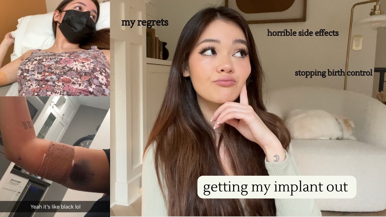 finally getting my nexplanon removed, horrible side effects, detox | my birth control experience
