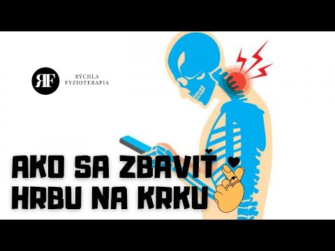 Video: Ako Sa Vyrovnať S Bolesťami Krku A Zátylku