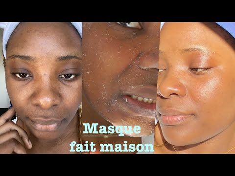 Vidéo: Comment se débarrasser des impuretés de la peau (avec des photos)