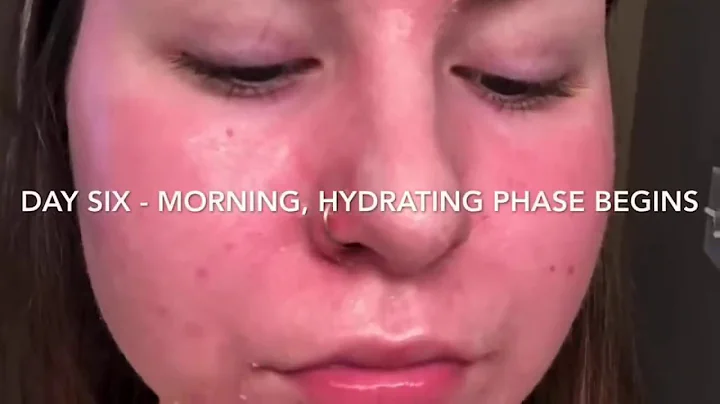 5 Day At Home ZO Retinol Peel