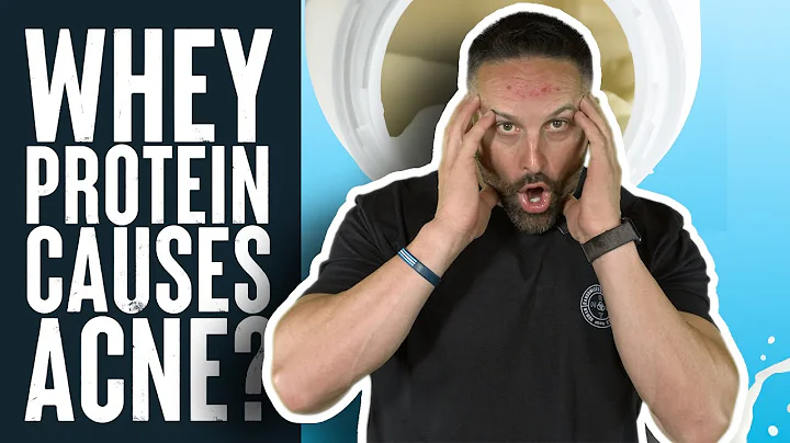 Whey Protein Causes Acne? | Educational Video | Biolayne