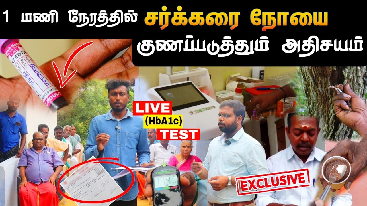 ஆயிரக்கணக்கான நபர்களை குணப்படுத்திய சாதனை மனிதர்  | Sugar Treatment in Tamil  | Edison vlogs