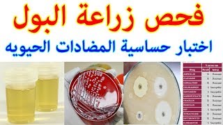 تعرف على فحص زراعة البول والحساسيه