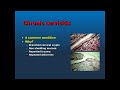 Management Of PID 