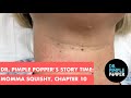 Dr. Pimple Popper's Weekly Story Time: Momma Squishy, Chapter 10!