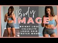 Let's Talk Body Image: 30kg Weight Loss Loose Skin, Stretch Marks, Cellulite, Psoriasis & Confidence