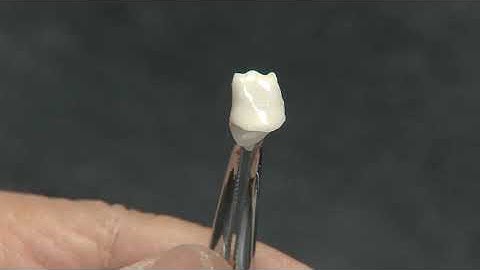 MDT. Hitoshi Aoshima using Cerabien ZR (CZR) for Build-up Technique. Part 1.