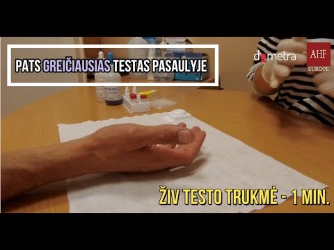 Video: Kas atliks integracijos testavimą?