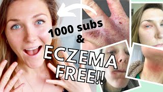 ECZEMA Cured! How I Healed My Eczema Naturally - 5 Eczema Healing Stages | Project Reverse complete!