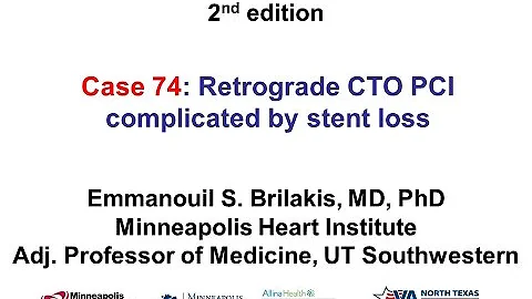 Case 74: Manual of CTO Interventions - Stent loss during retrograde CTO PCI