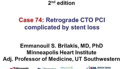 Case 74: Manual of CTO Interventions - Stent loss during retrograde CTO PCI