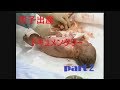 【感動！】双子出産ドキュメンタリー（part2）