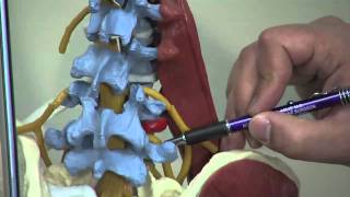 Spine Treatment Center - Nerve Root Block, Non-Surgical