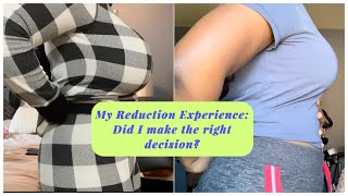 My Reduction Experience: Did I make the right decision?!