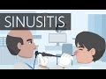 What is sinusitis