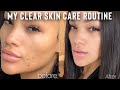 MY CLEAR SKIN CARE ROUTINE 2020 | HOW I CLEARED MY SKIN EASY! | ALLYIAHSFACE