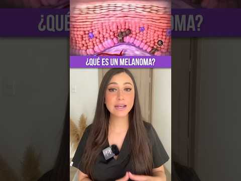 Video: ¿Pueden las hormonas causar melanoma?