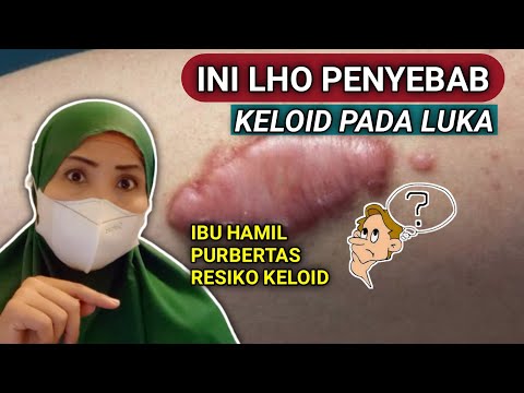 BAGAIMANA CARA MENGHILANGKAN KELOID PADA LUKA - PENYEBAB KELOID PADA KULIT- KELOID NYERI DAN GATAL