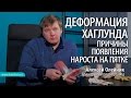 ДЕФОРМАЦИЯ ХАГЛУНДА (ОСТЕОФИТ ПЯТОЧНОЙ КОСТИ) причины появления шишки на пятке Алексей Олейник